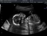2D Pregnancy Ultrasound Studio