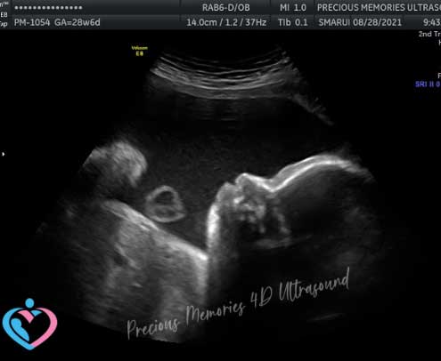 22D Pregnancy Ultrasound Imaging