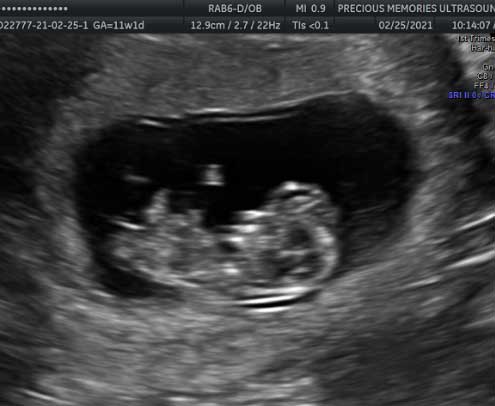 2D Pregnancy Ultrasound Studio