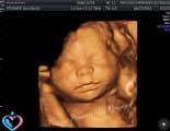 Pregnancy Ultrasound Center