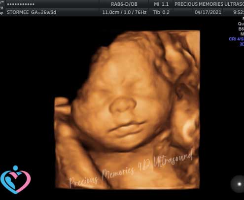 3D Pregnancy Ultrasounds Near Me