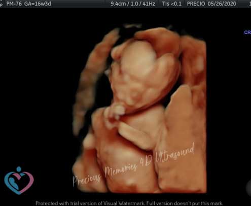 Pregnancy Ultrasound Imaging