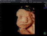 Pregnancy Ultrasound Experts