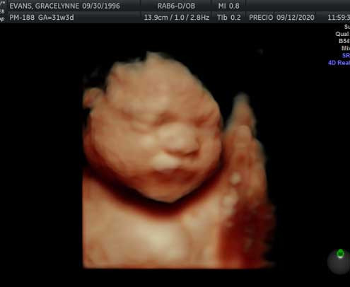 Pregnancy Ultrasound Stuido in Humble TX