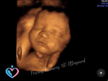 Ultrasounds for Pregnancy